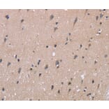 Immunohistochemistry - KIAA1324 Antibody from Signalway Antibody (36440) - Antibodies.com