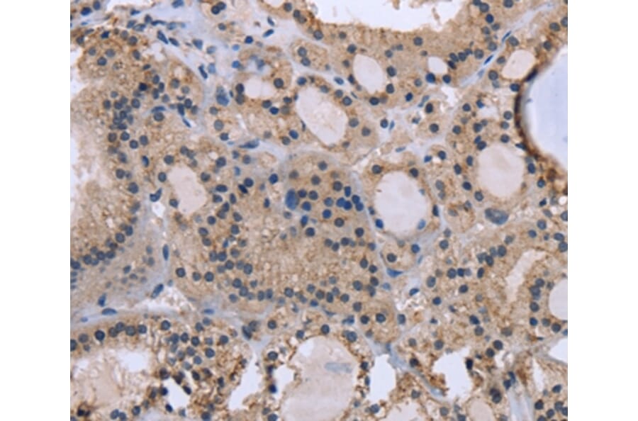 Immunohistochemistry - KIAA1324 Antibody from Signalway Antibody (36440) - Antibodies.com