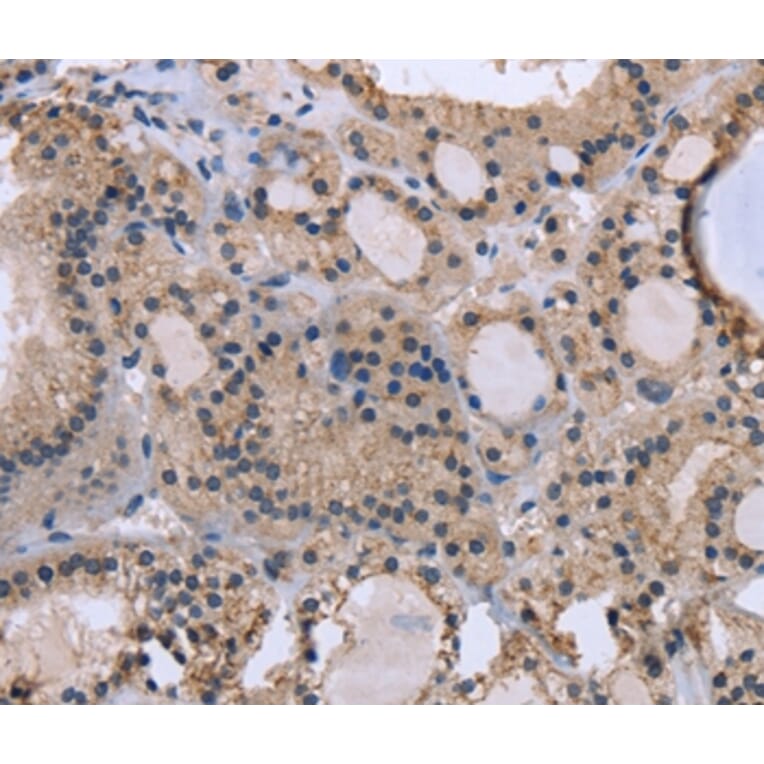 Immunohistochemistry - KIAA1324 Antibody from Signalway Antibody (36440) - Antibodies.com