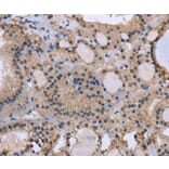 Immunohistochemistry - KIAA1324 Antibody from Signalway Antibody (36440) - Antibodies.com