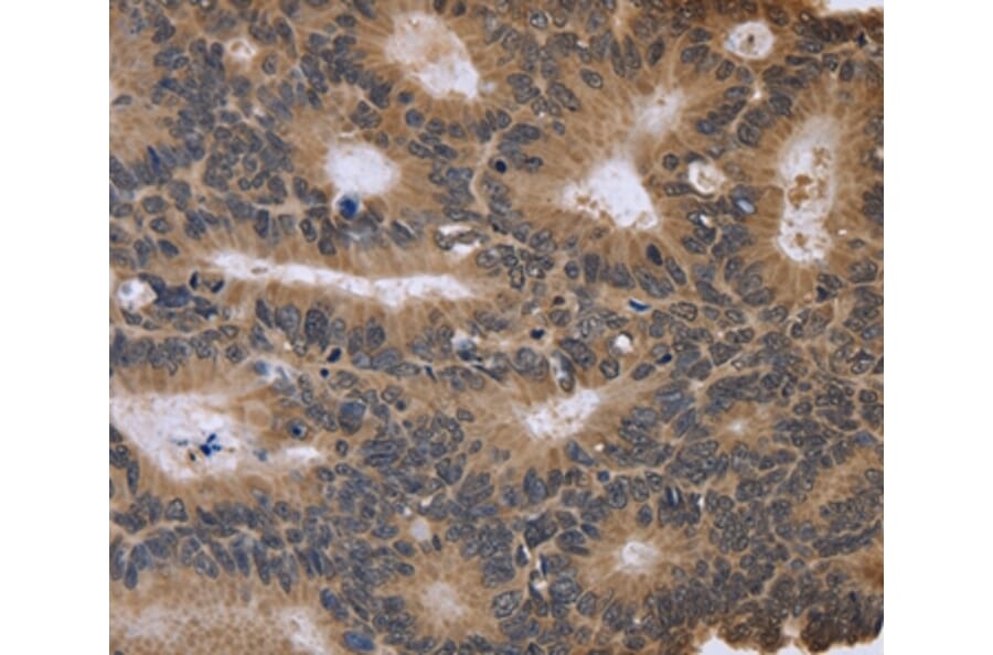 Immunohistochemistry - FGFR1OP2 Antibody from Signalway Antibody (36480) - Antibodies.com