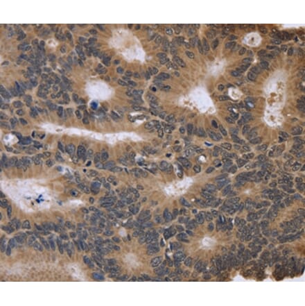 Immunohistochemistry - FGFR1OP2 Antibody from Signalway Antibody (36480) - Antibodies.com