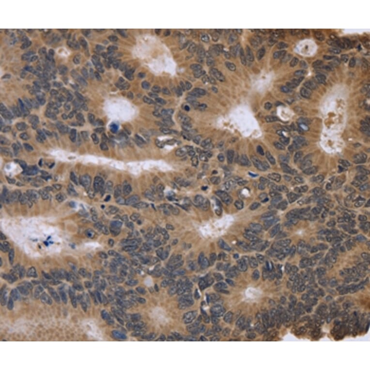 Immunohistochemistry - FGFR1OP2 Antibody from Signalway Antibody (36480) - Antibodies.com