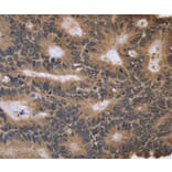 Immunohistochemistry - FGFR1OP2 Antibody from Signalway Antibody (36480) - Antibodies.com