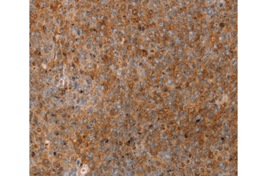 Immunohistochemistry - SERPINB2 Antibody from Signalway Antibody (36679) - Antibodies.com