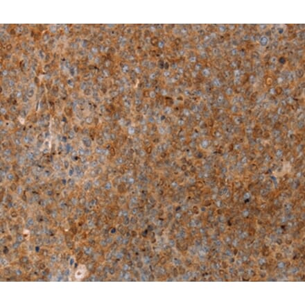 Immunohistochemistry - SERPINB2 Antibody from Signalway Antibody (36679) - Antibodies.com