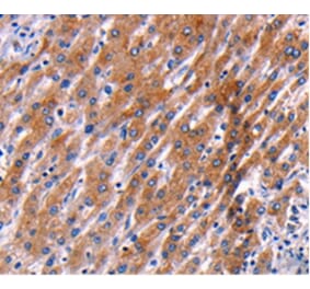 Immunohistochemistry - PPP1R13B Antibody from Signalway Antibody (36764) - Antibodies.com