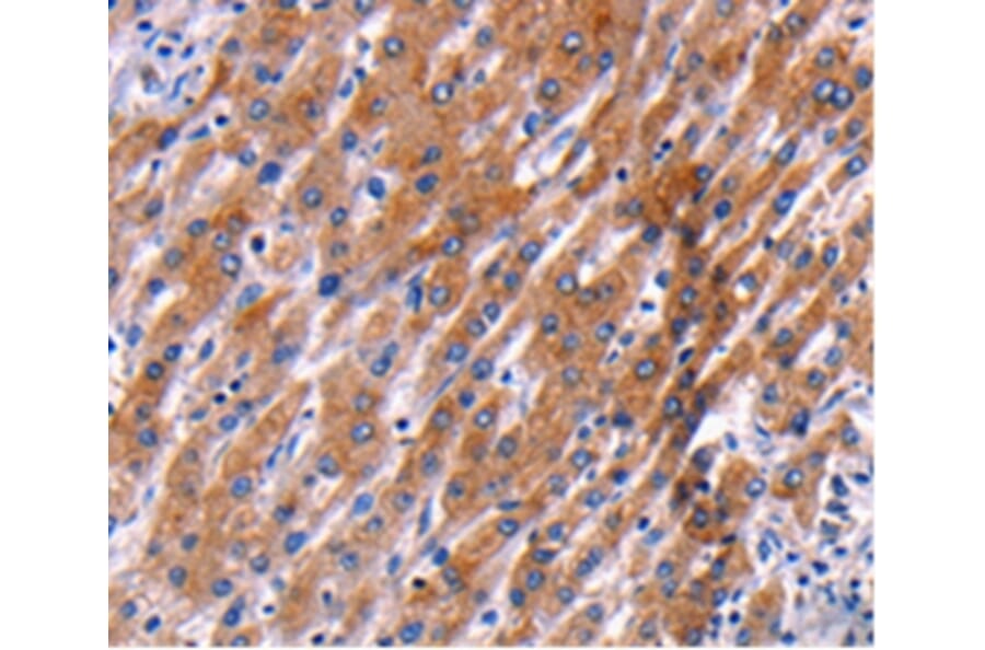 Immunohistochemistry - PPP1R13B Antibody from Signalway Antibody (36764) - Antibodies.com
