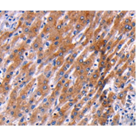 Immunohistochemistry - PPP1R13B Antibody from Signalway Antibody (36764) - Antibodies.com