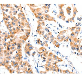Immunohistochemistry - PAFAH1B1 Antibody from Signalway Antibody (36952) - Antibodies.com