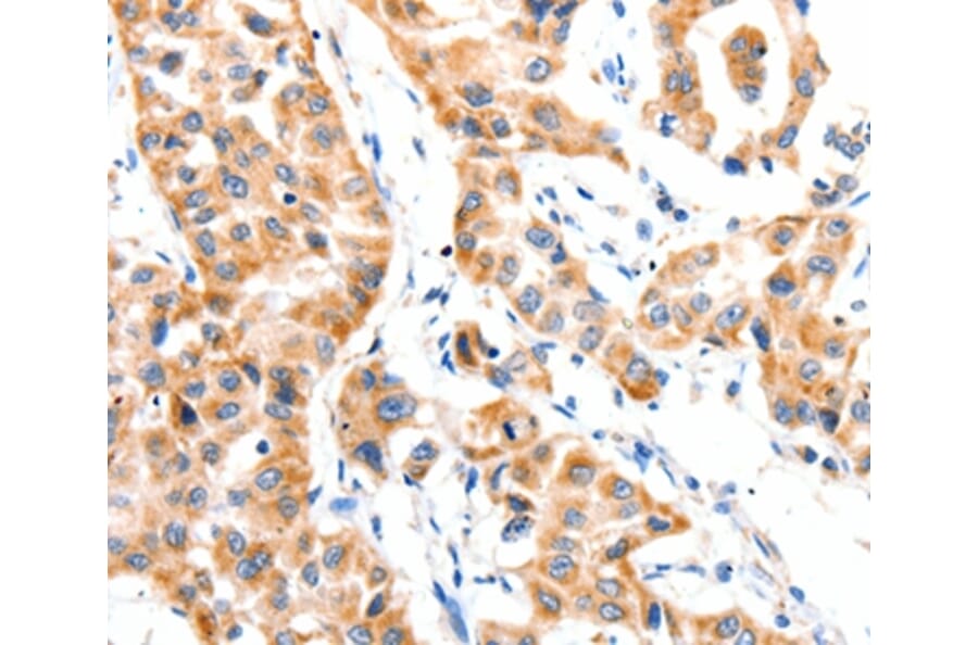 Immunohistochemistry - PAFAH1B1 Antibody from Signalway Antibody (36952) - Antibodies.com