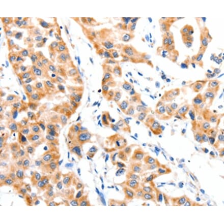 Immunohistochemistry - PAFAH1B1 Antibody from Signalway Antibody (36952) - Antibodies.com