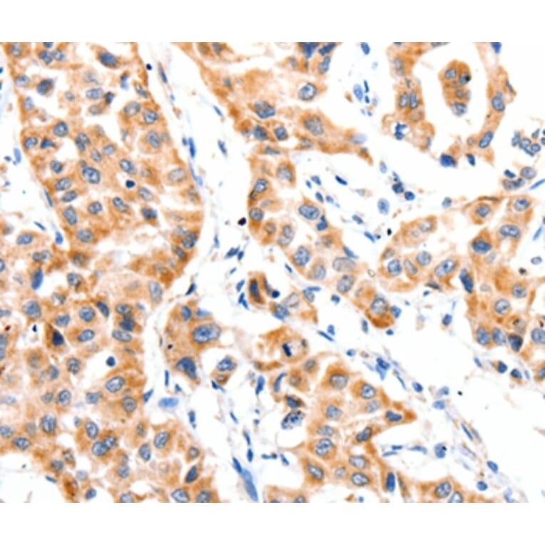 Immunohistochemistry - PAFAH1B1 Antibody from Signalway Antibody (36952) - Antibodies.com