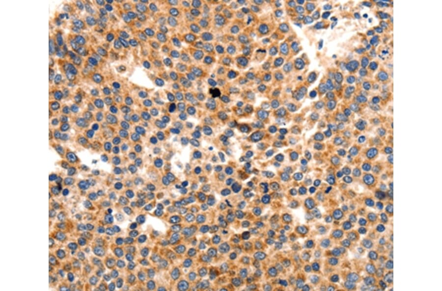 Immunohistochemistry - PAFAH1B1 Antibody from Signalway Antibody (36952) - Antibodies.com