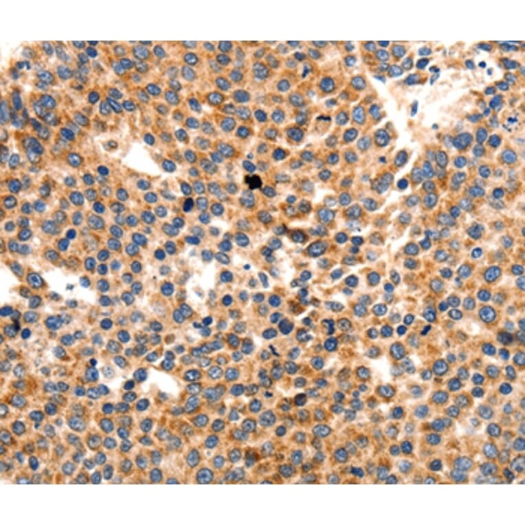 Immunohistochemistry - PAFAH1B1 Antibody from Signalway Antibody (36952) - Antibodies.com