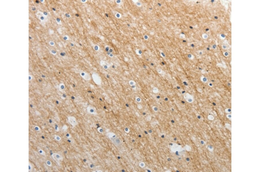Immunohistochemistry - ADAMTS19 Antibody from Signalway Antibody (37081) - Antibodies.com