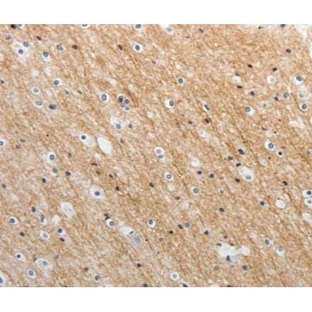 Immunohistochemistry - ADAMTS19 Antibody from Signalway Antibody (37081) - Antibodies.com