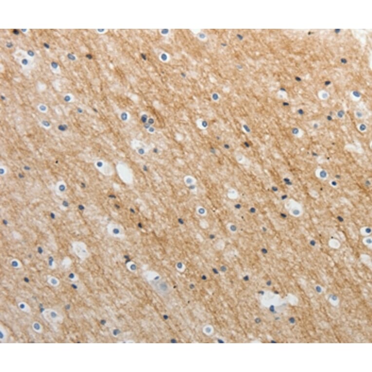 Immunohistochemistry - ADAMTS19 Antibody from Signalway Antibody (37081) - Antibodies.com