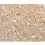 Immunohistochemistry - ADAMTS19 Antibody from Signalway Antibody (37081) - Antibodies.com