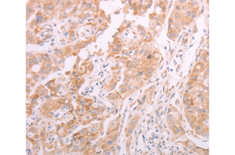 Immunohistochemistry - ADAMTS10 Antibody from Signalway Antibody (37310) - Antibodies.com