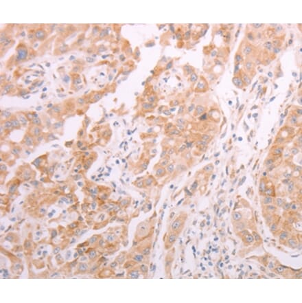 Immunohistochemistry - ADAMTS10 Antibody from Signalway Antibody (37310) - Antibodies.com