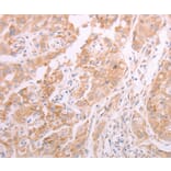 Immunohistochemistry - ADAMTS10 Antibody from Signalway Antibody (37310) - Antibodies.com