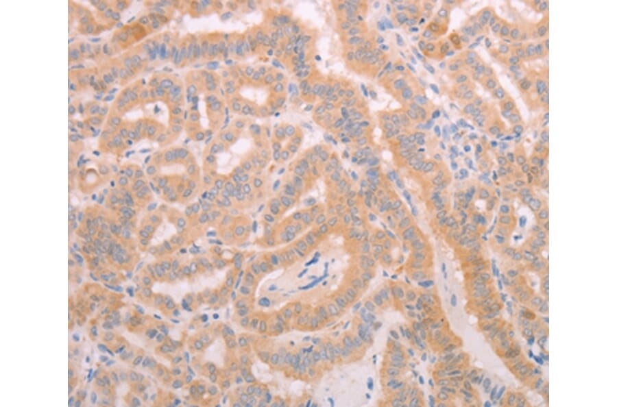 Immunohistochemistry - ADAMTS10 Antibody from Signalway Antibody (37310) - Antibodies.com