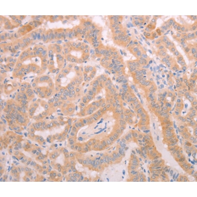 Immunohistochemistry - ADAMTS10 Antibody from Signalway Antibody (37310) - Antibodies.com