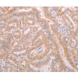 Immunohistochemistry - ADAMTS10 Antibody from Signalway Antibody (37310) - Antibodies.com