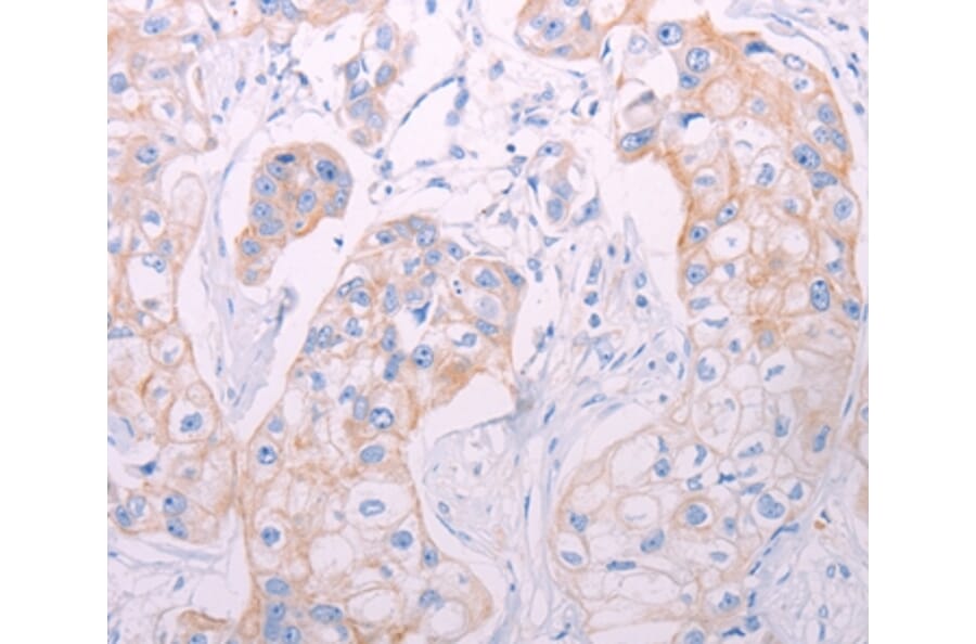 Immunohistochemistry - ADAMTS14 Antibody from Signalway Antibody (37313) - Antibodies.com