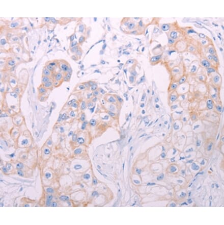 Immunohistochemistry - ADAMTS14 Antibody from Signalway Antibody (37313) - Antibodies.com