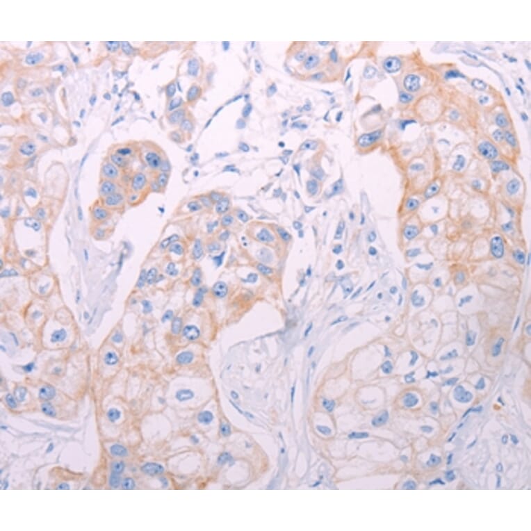 Immunohistochemistry - ADAMTS14 Antibody from Signalway Antibody (37313) - Antibodies.com