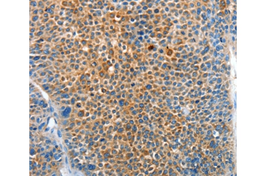 Immunohistochemistry - SERPINF2 Antibody from Signalway Antibody (37330) - Antibodies.com