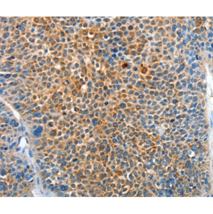 Immunohistochemistry - SERPINF2 Antibody from Signalway Antibody (37330) - Antibodies.com