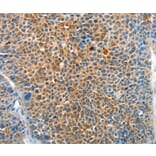 Immunohistochemistry - SERPINF2 Antibody from Signalway Antibody (37330) - Antibodies.com