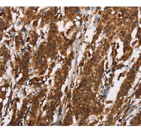 Immunohistochemistry - CTAG1A/B Antibody from Signalway Antibody (37512) - Antibodies.com
