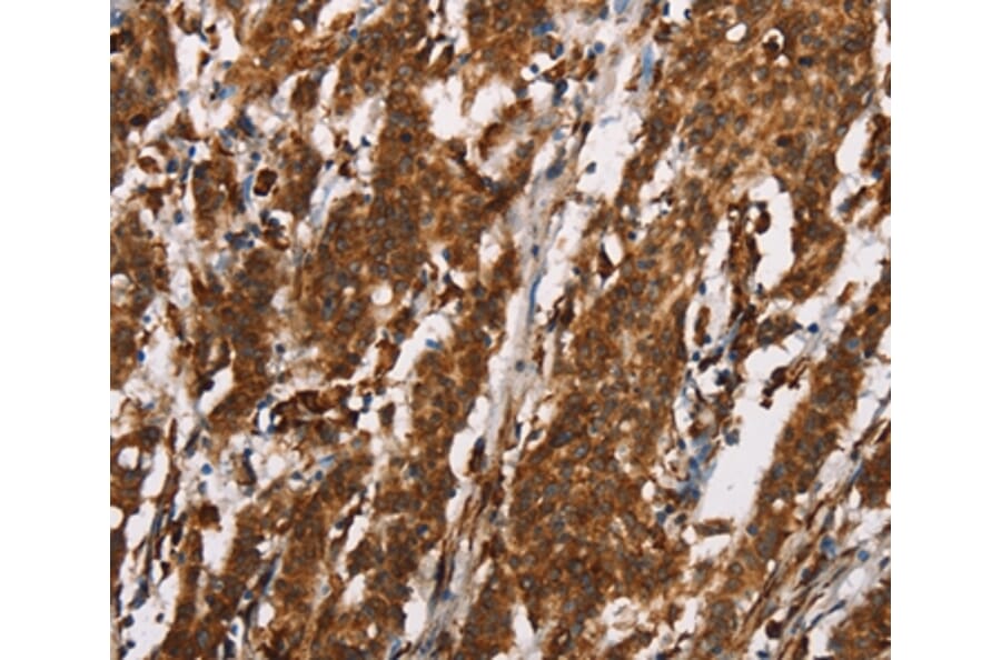 Immunohistochemistry - CTAG1A/B Antibody from Signalway Antibody (37512) - Antibodies.com