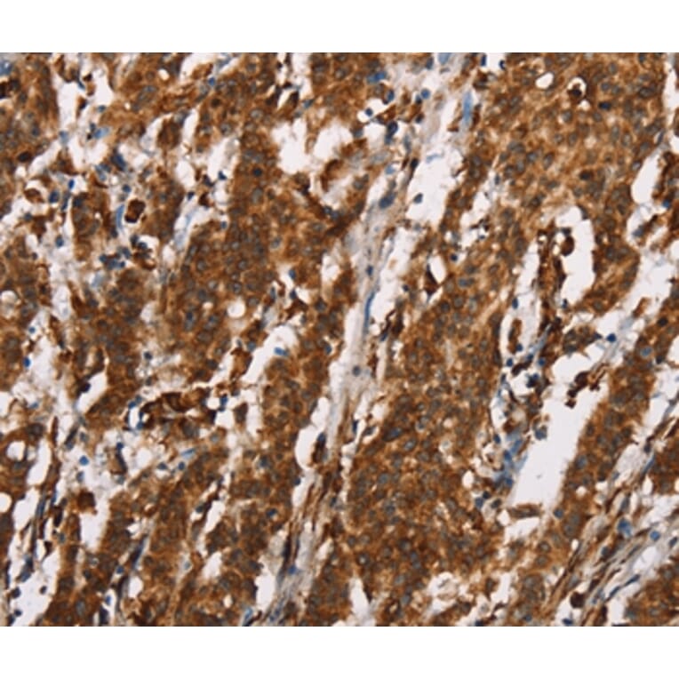 Immunohistochemistry - CTAG1A/B Antibody from Signalway Antibody (37512) - Antibodies.com