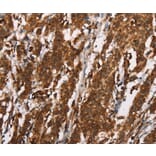 Immunohistochemistry - CTAG1A/B Antibody from Signalway Antibody (37512) - Antibodies.com