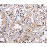 Immunohistochemistry - CTAG1A/B Antibody from Signalway Antibody (37512) - Antibodies.com