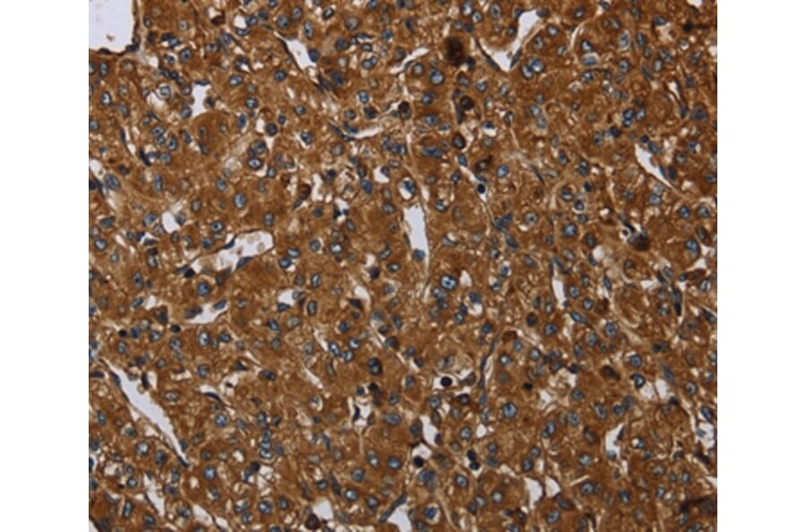 Immunohistochemistry - ARHGEF12 Antibody from Signalway Antibody (37694) - Antibodies.com