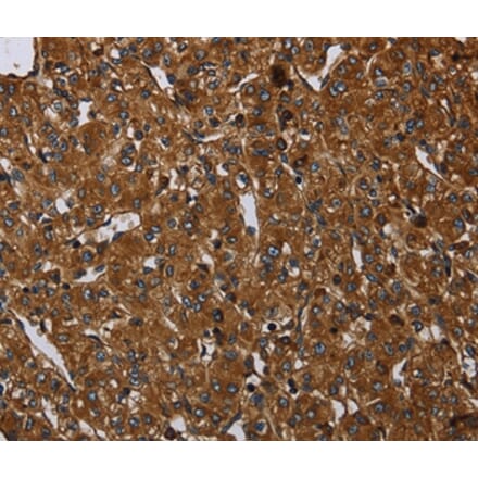 Immunohistochemistry - ARHGEF12 Antibody from Signalway Antibody (37694) - Antibodies.com