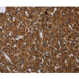 Immunohistochemistry - ARHGEF12 Antibody from Signalway Antibody (37694) - Antibodies.com