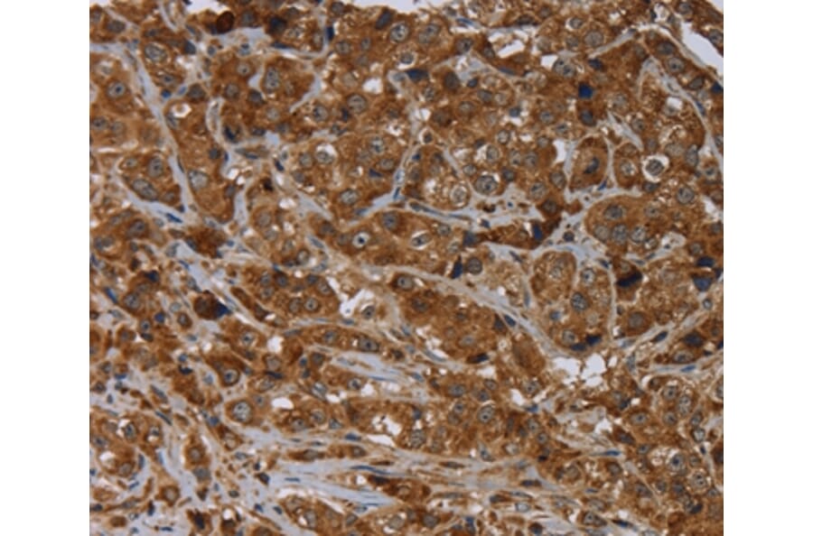 Immunohistochemistry - ARHGEF12 Antibody from Signalway Antibody (37694) - Antibodies.com