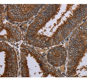 Immunohistochemistry - C12orf75 Antibody from Signalway Antibody (37781) - Antibodies.com
