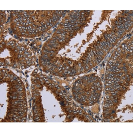 Immunohistochemistry - C12orf75 Antibody from Signalway Antibody (37781) - Antibodies.com