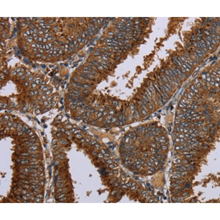 Immunohistochemistry - C12orf75 Antibody from Signalway Antibody (37781) - Antibodies.com