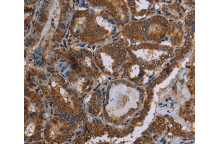 Immunohistochemistry - C12orf75 Antibody from Signalway Antibody (37781) - Antibodies.com