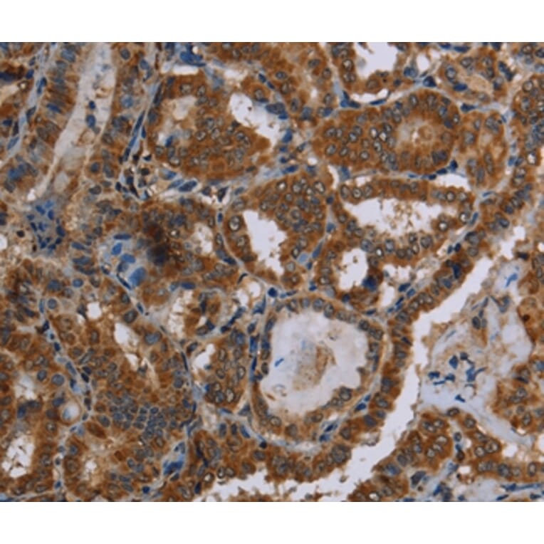 Immunohistochemistry - C12orf75 Antibody from Signalway Antibody (37781) - Antibodies.com