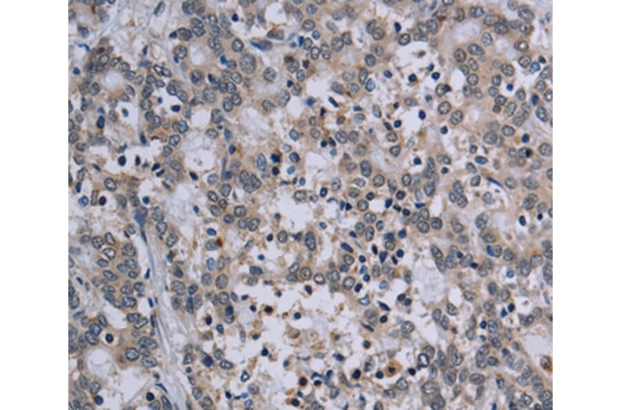 Immunohistochemistry - TP53AIP1 Antibody from Signalway Antibody (37791) - Antibodies.com